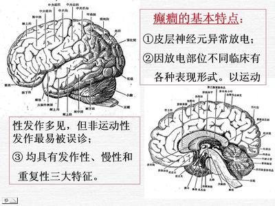 儿童癫痫的早期症状有哪些