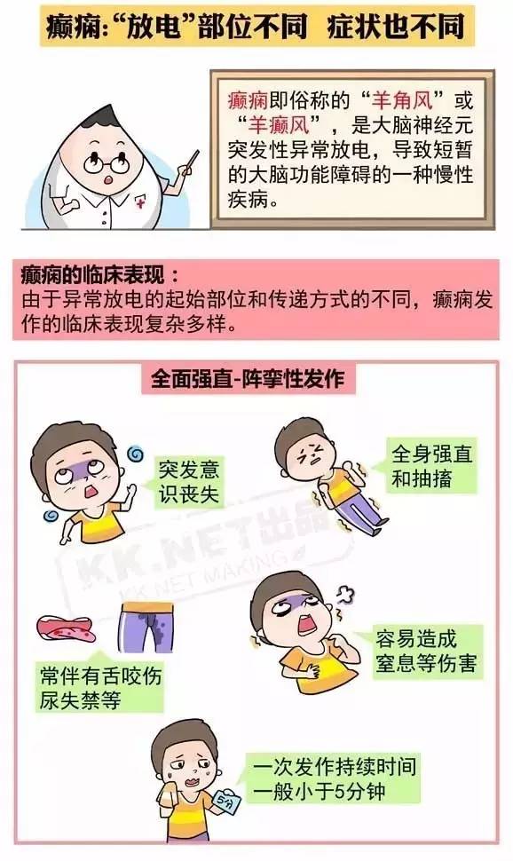 几种常见儿童癫痫的主要特点