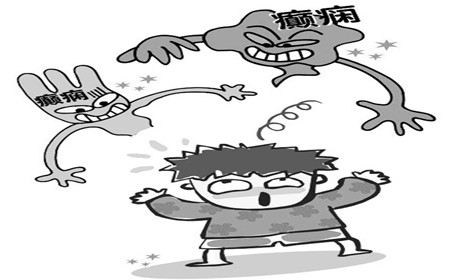 为什么会出现癫痫